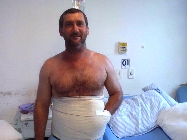Após um ano, homem que passou 42 dias com a mão dentro do abdômen passará por nova cirurgia